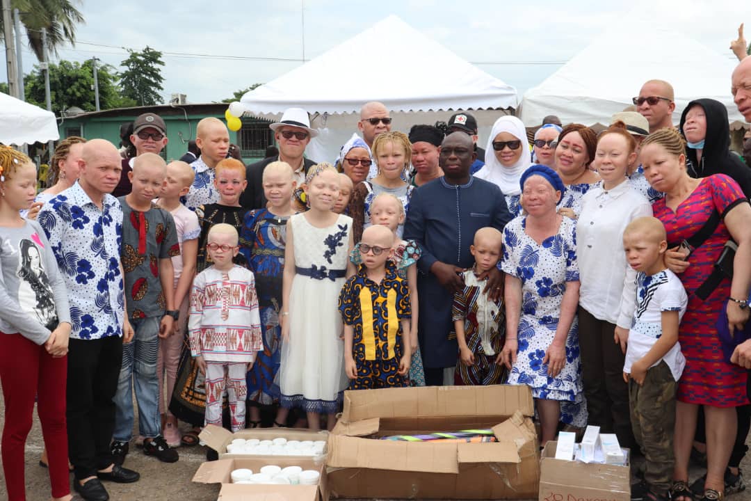 Bigger Picture Clothing in de strijd tegen albinisme in Afrika